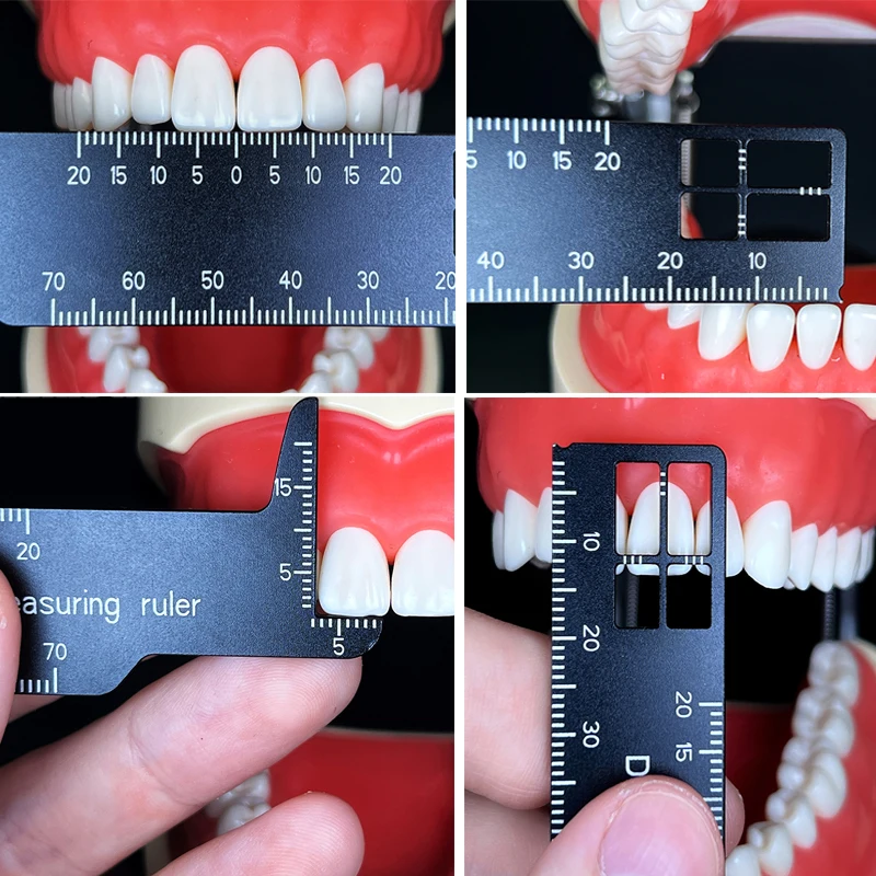 Autoclavable Dental Precision  - Photography Rules incelemesi ve fiyatı