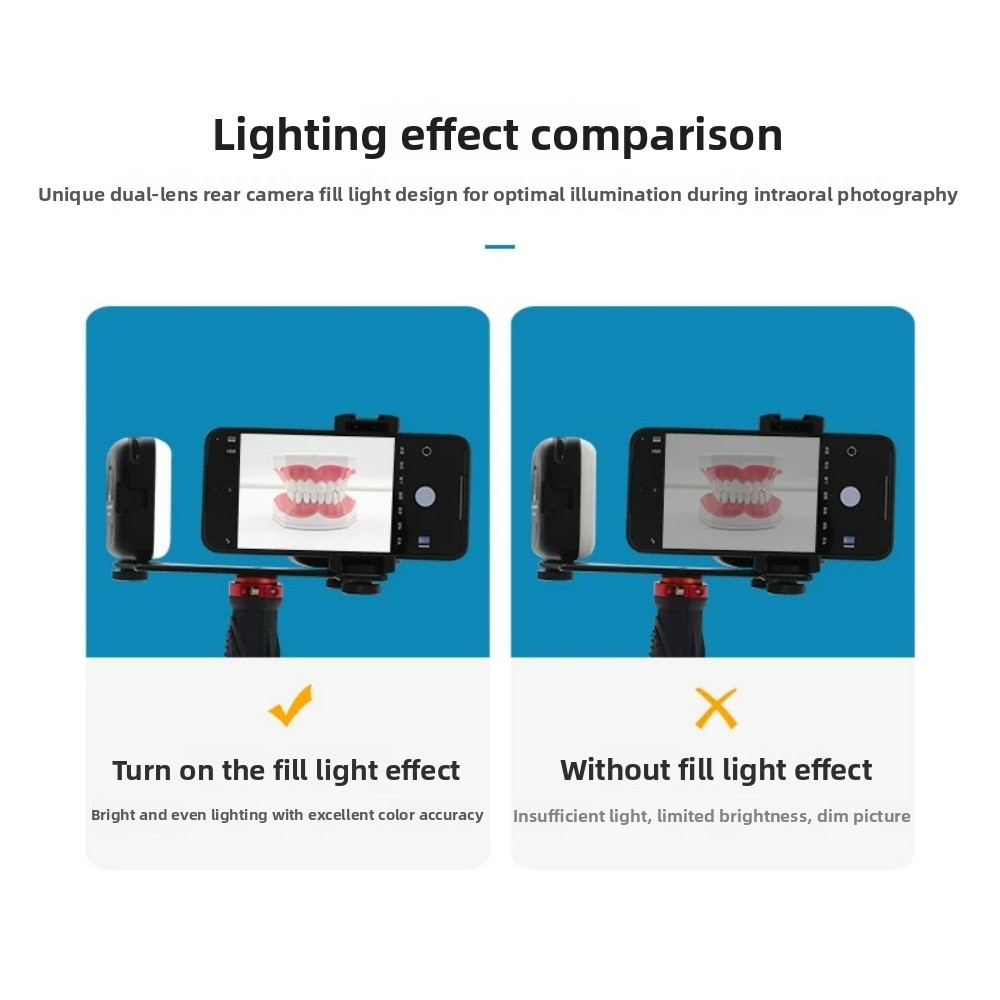 Dental Photography Light, Blue - Photography Basic incelemesi ve fiyatı